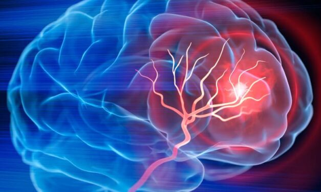 Stroke: Natural nutrients that help support stroke recovery…
